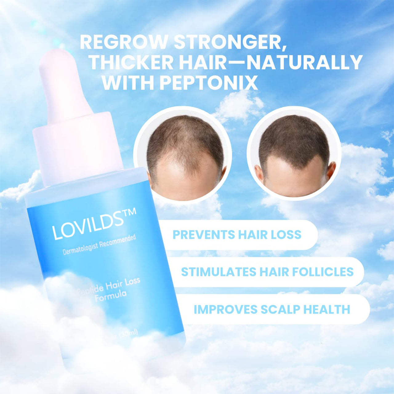 LOVILDS™ Clinically Backed Hair Regrowth Formula Trusted by Experts